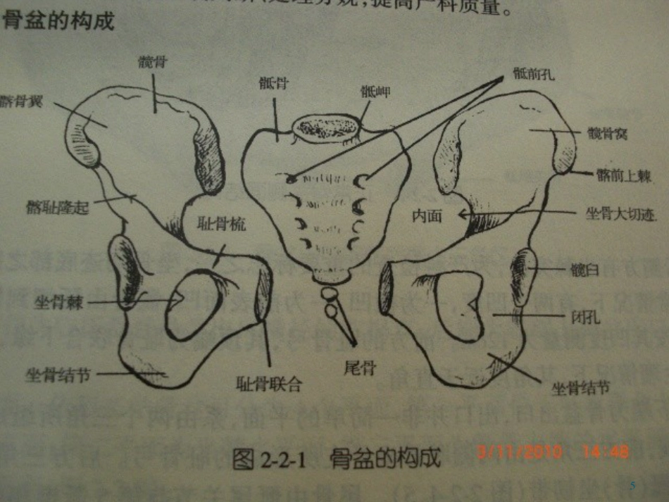 骨盆骨折护理PPT幻灯片_第5页