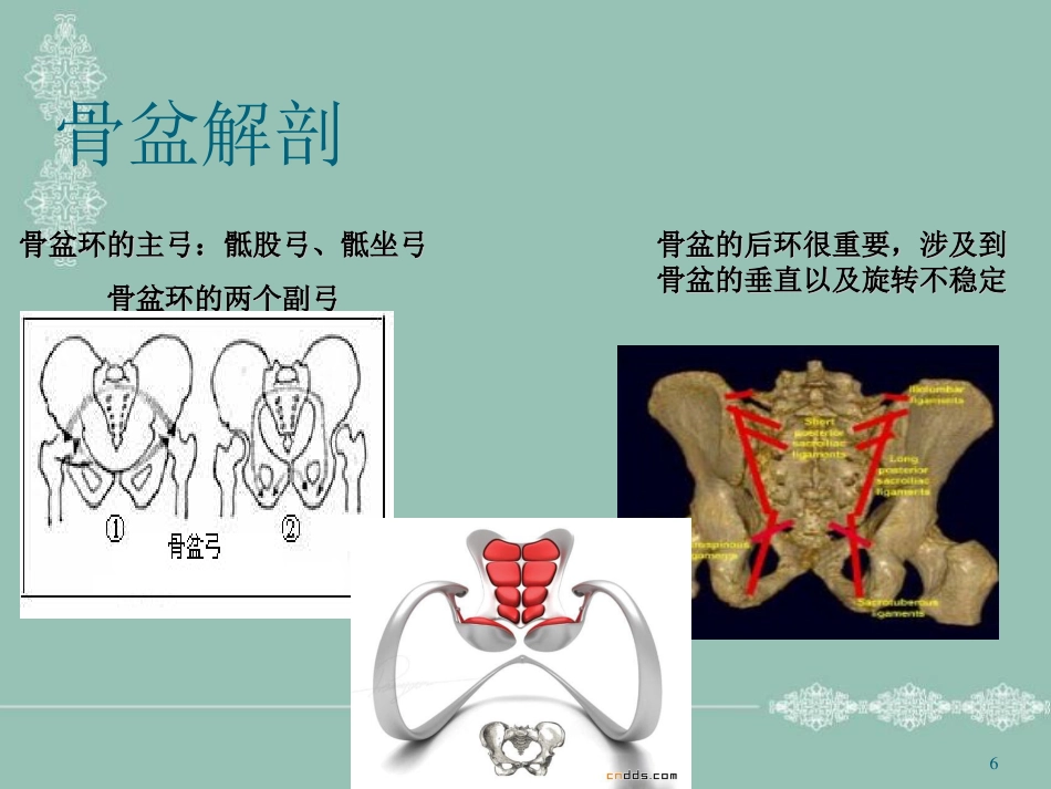 骨盆骨折护理PPT幻灯片_第6页