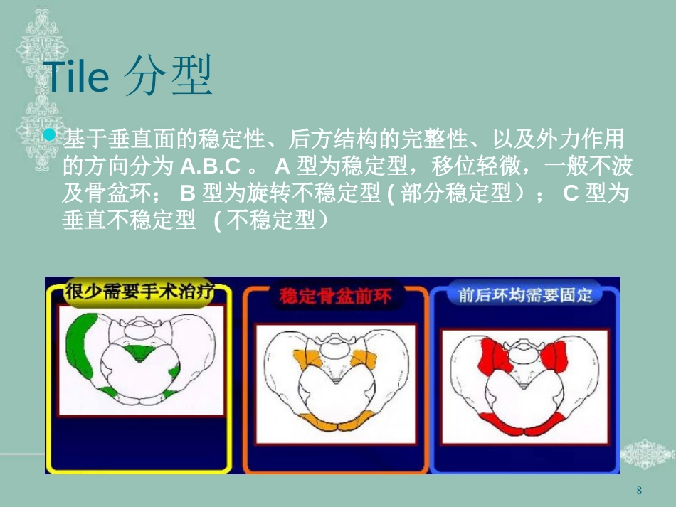 骨盆骨折护理PPT幻灯片_第8页