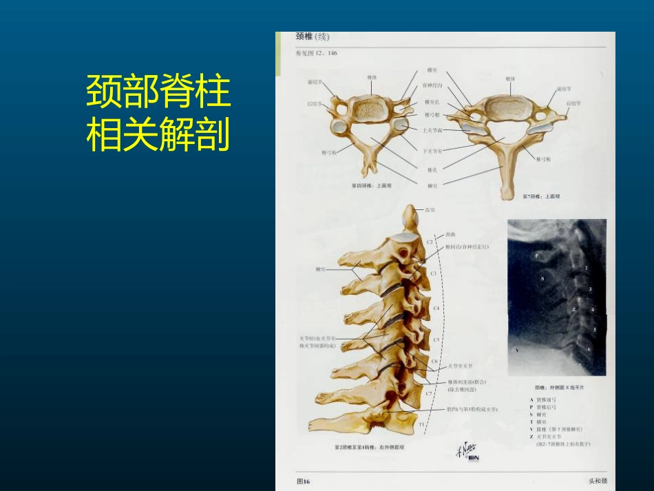 颈椎病的MRI诊断_第3页