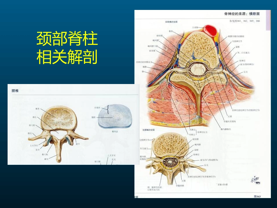 颈椎病的MRI诊断_第4页