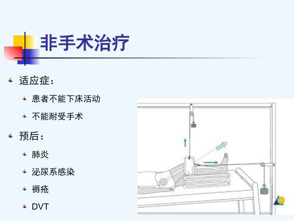 股骨粗隆间骨折内固定_第15页