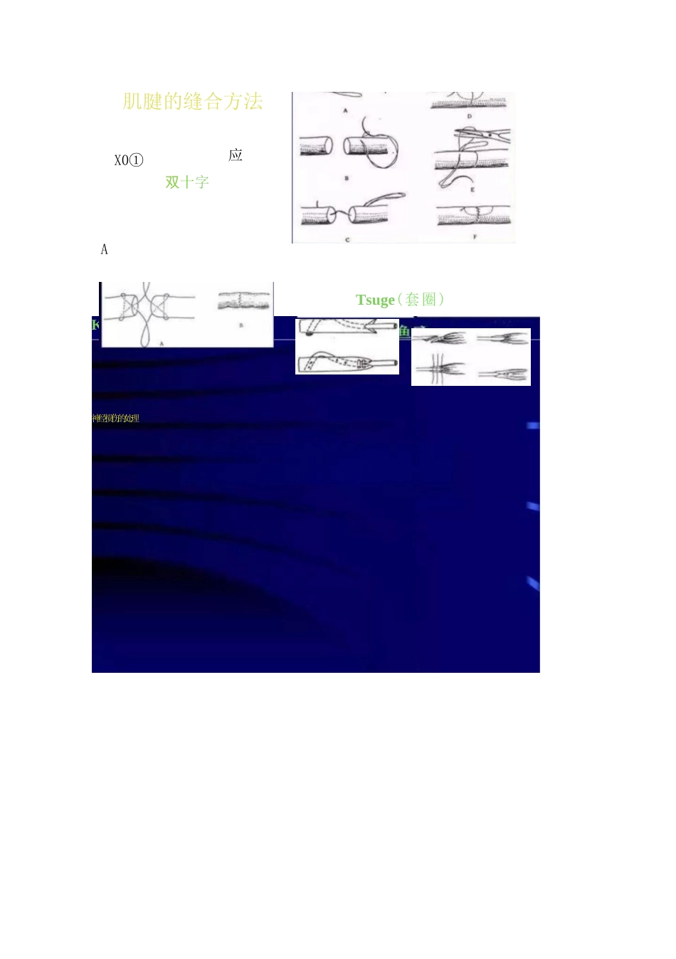 手外伤的常见处理策略及要点_第13页