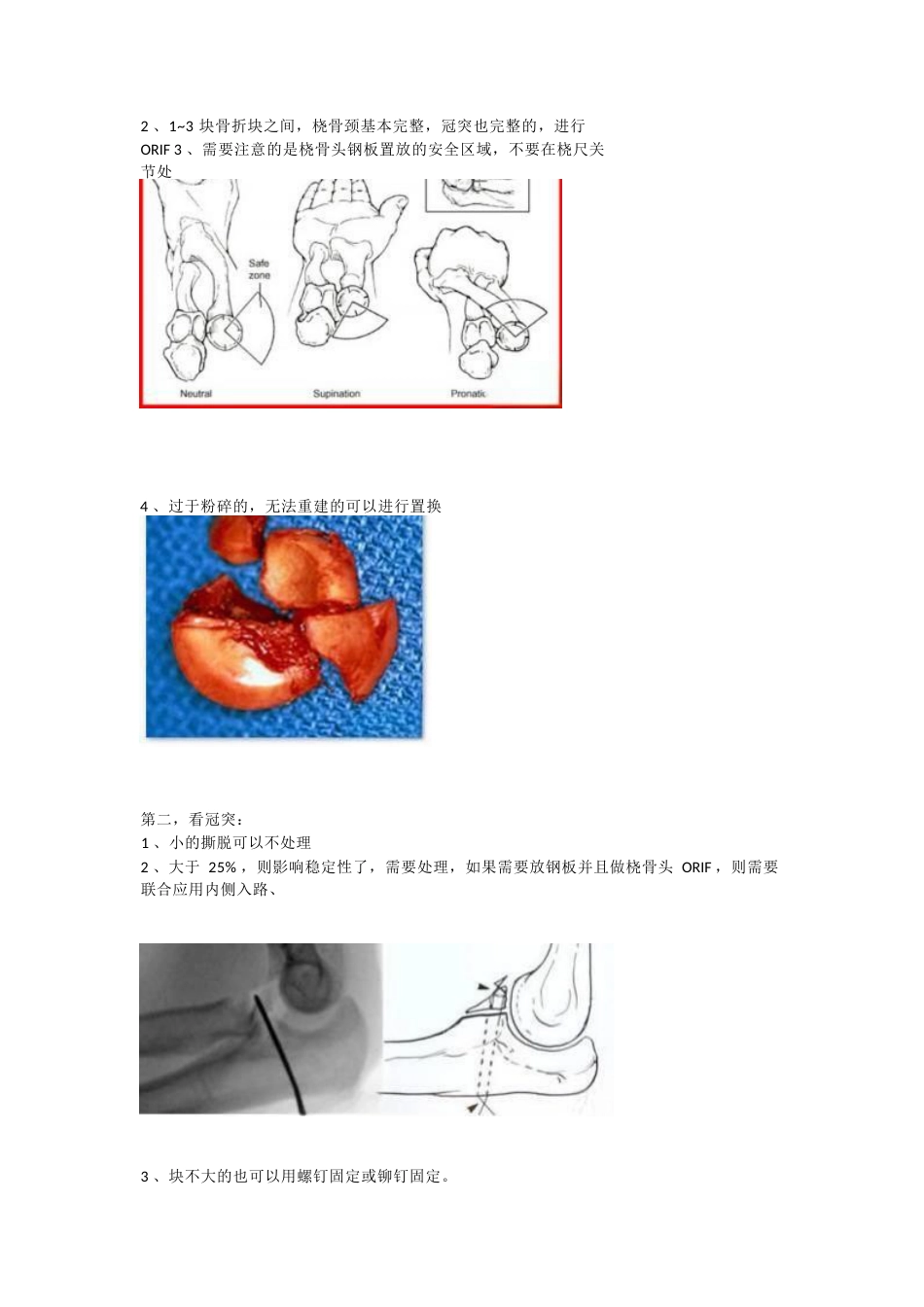 肘关节恐怖三联征治疗策略与技巧_第3页