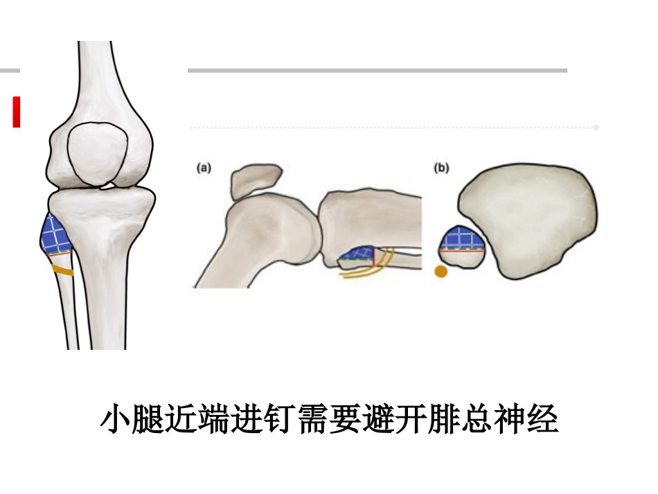 外架的基本理论_第15页