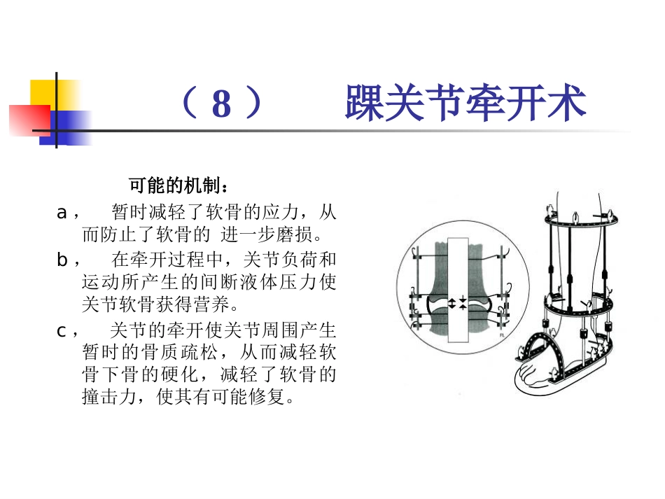 踝关节骨性关节炎_第13页