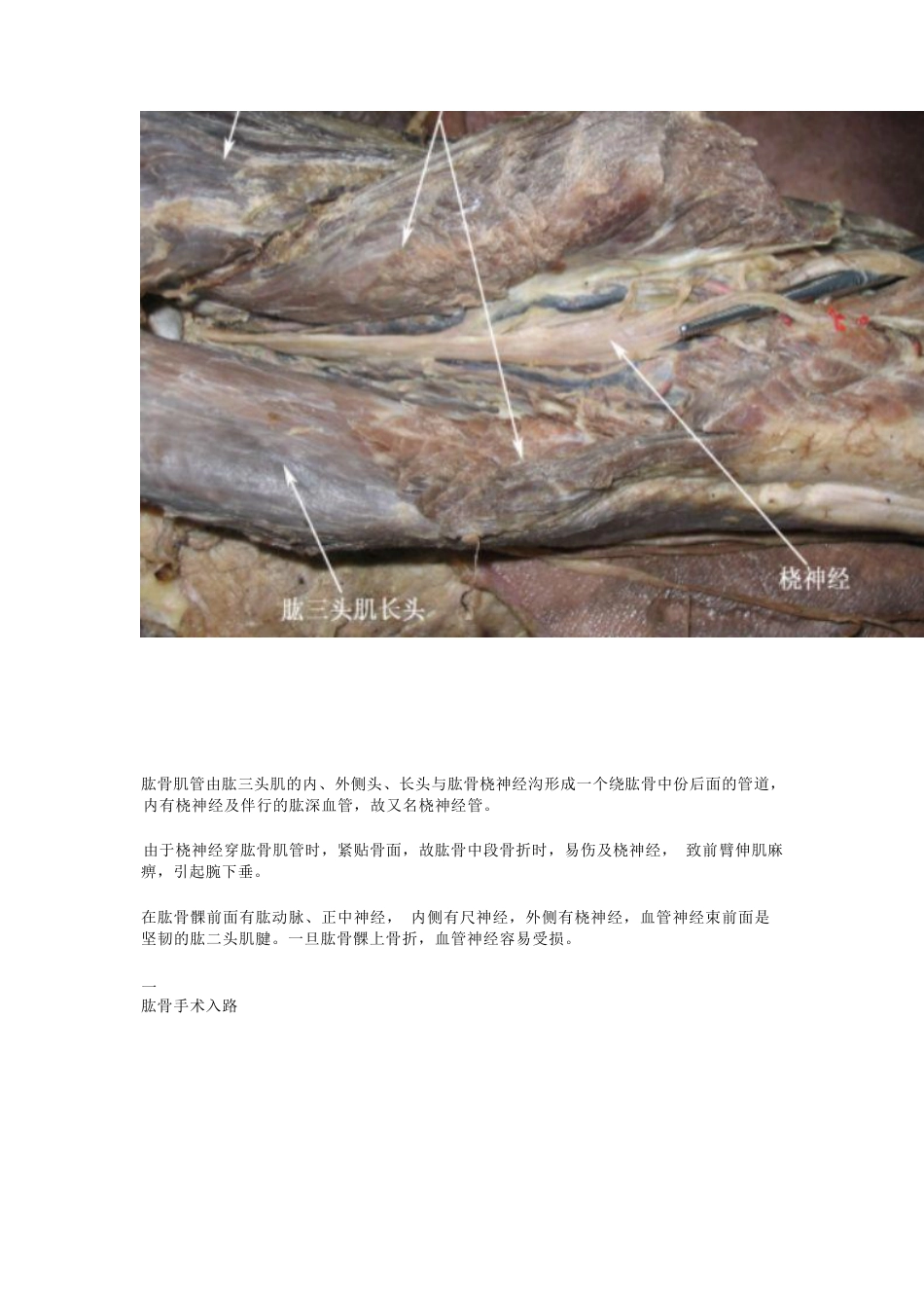 骨科解剖及手术切口入路_第10页