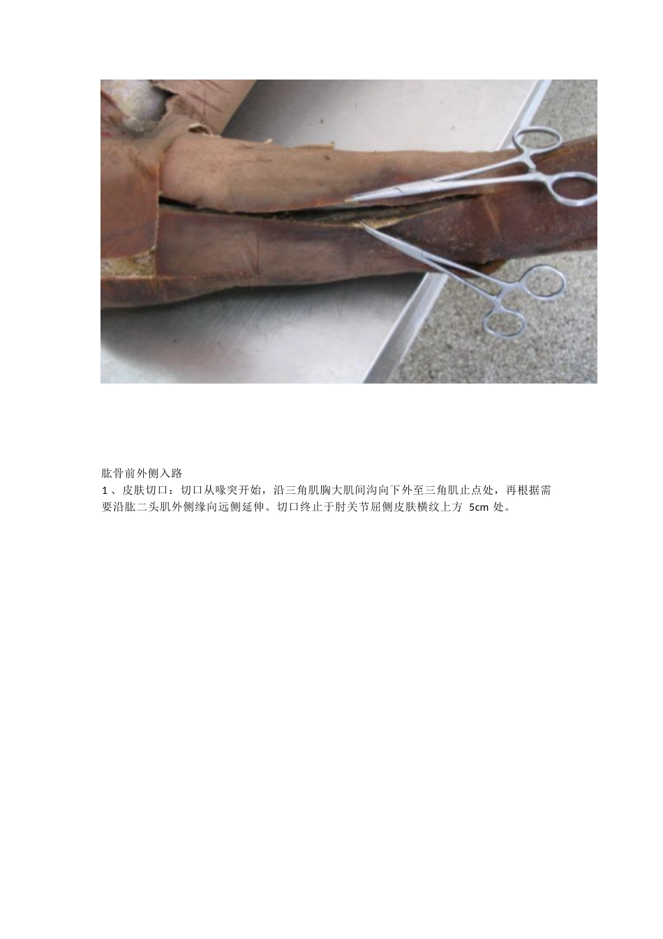 骨科解剖及手术切口入路_第11页