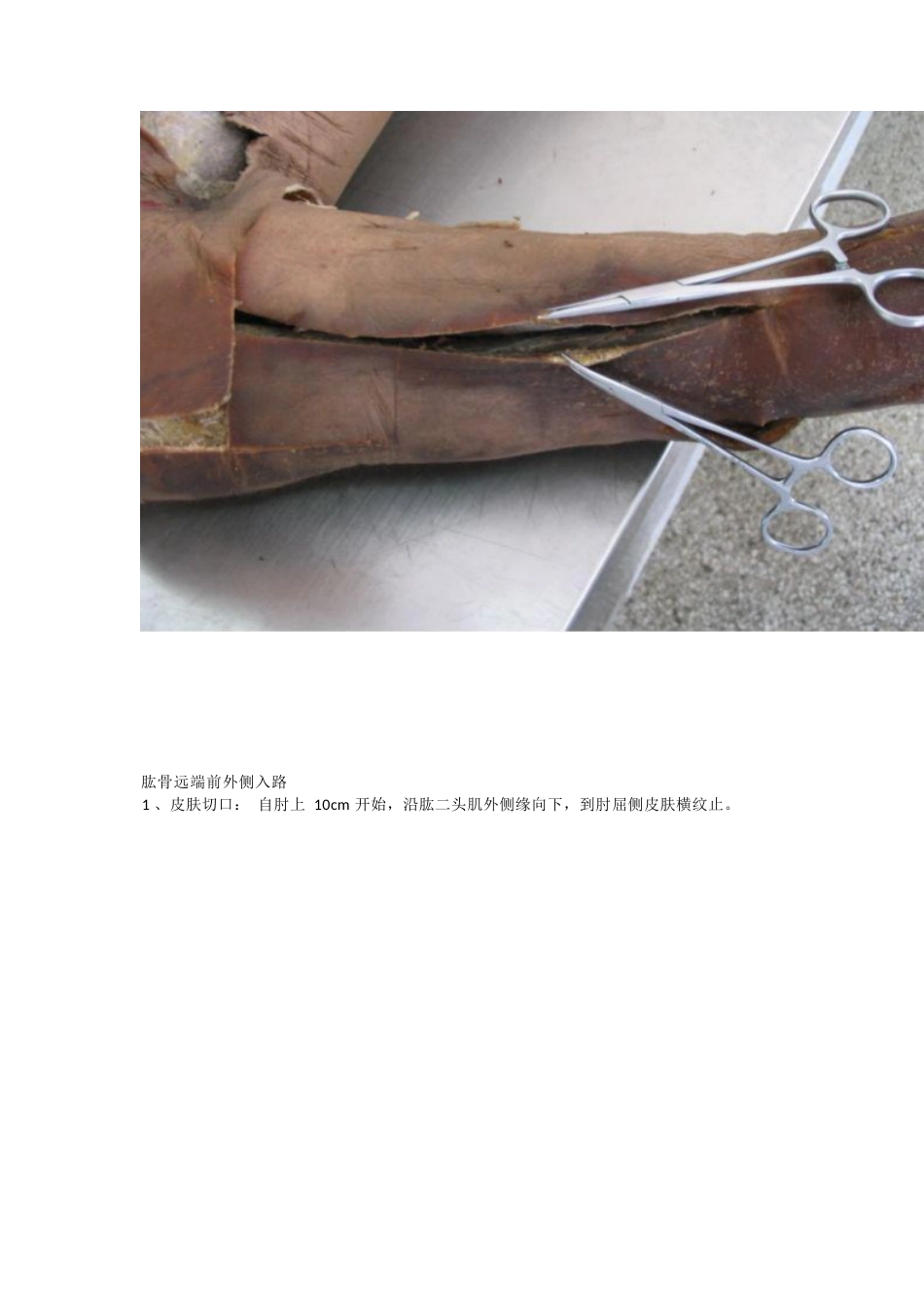 骨科解剖及手术切口入路_第14页