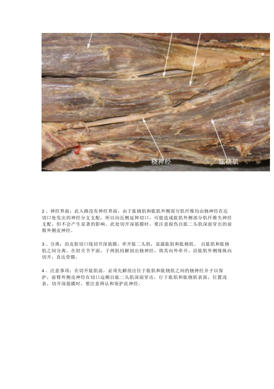 骨科解剖及手术切口入路_第15页