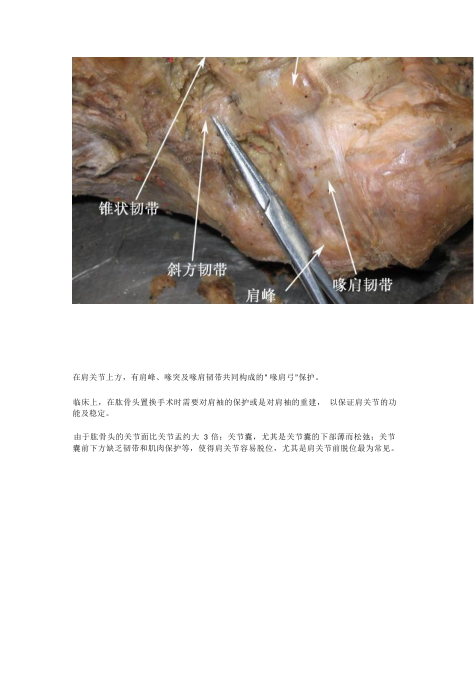 骨科解剖及手术切口入路_第4页