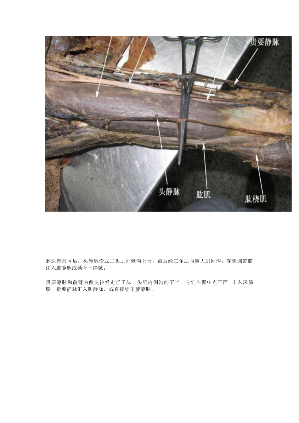 骨科解剖及手术切口入路_第6页