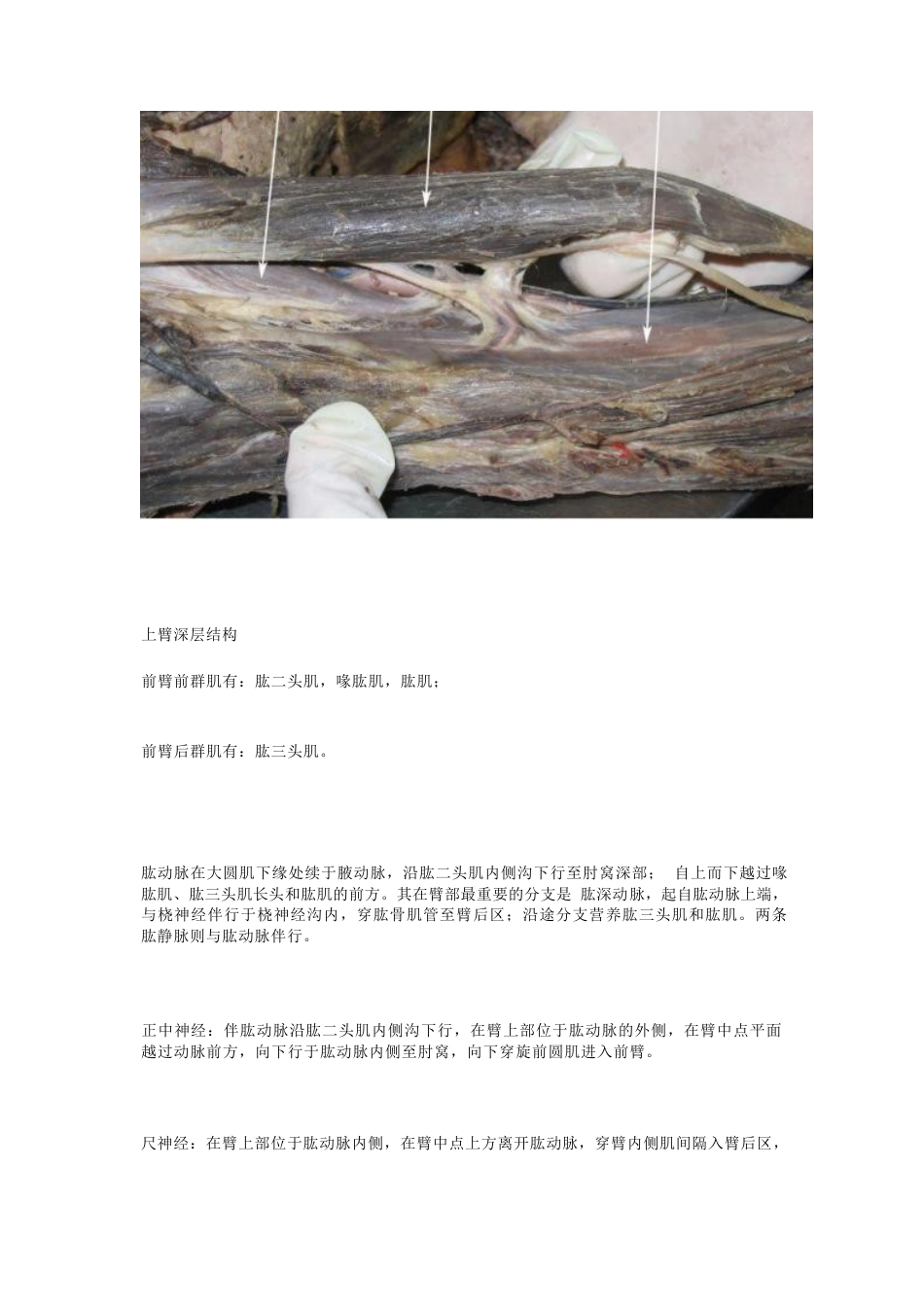 骨科解剖及手术切口入路_第7页