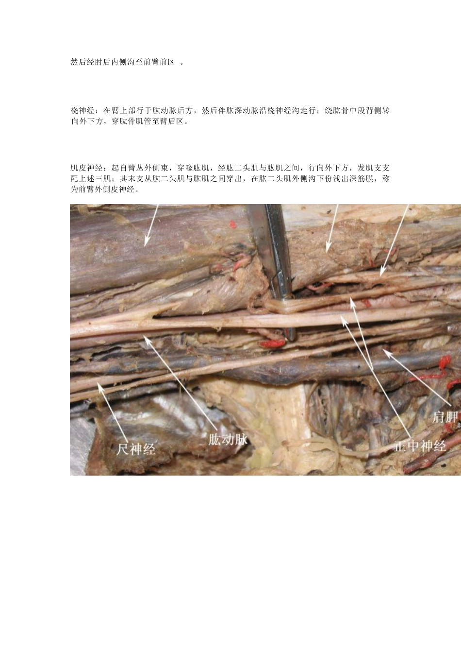 骨科解剖及手术切口入路_第8页