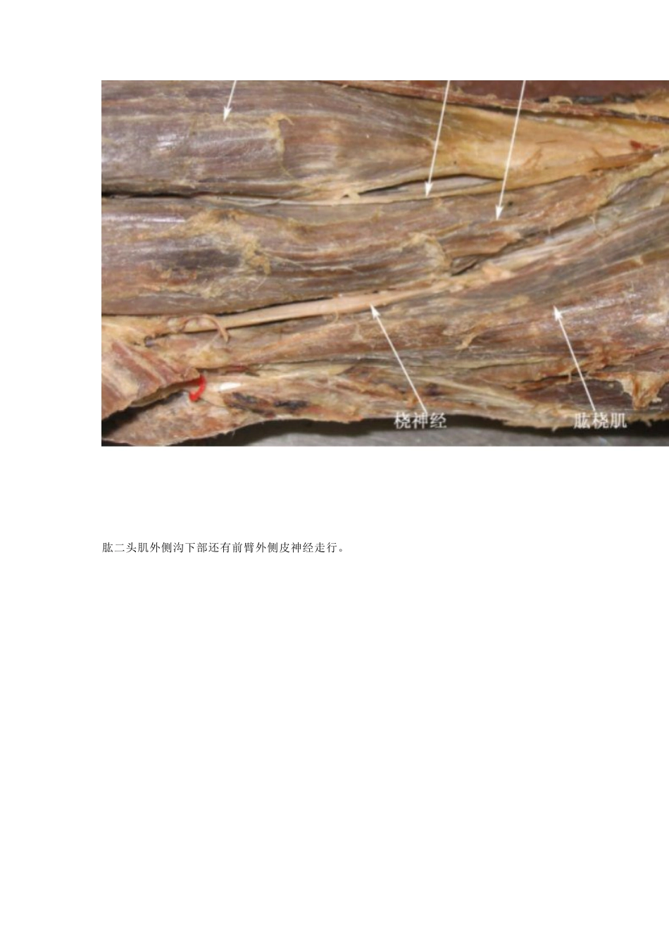 骨科解剖及手术切口入路_第9页