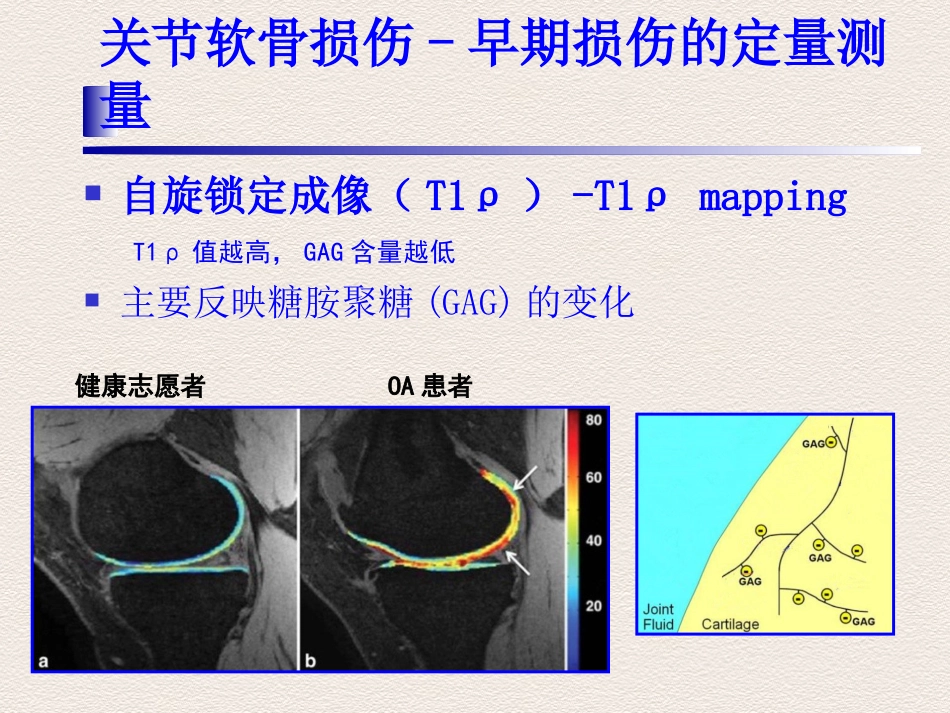 踝关节运动损伤MR诊断价值_第7页