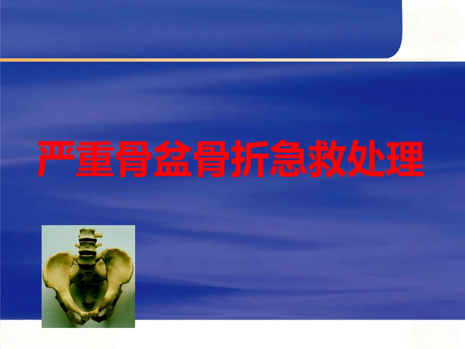严重骨盆骨折的急救处理_第1页