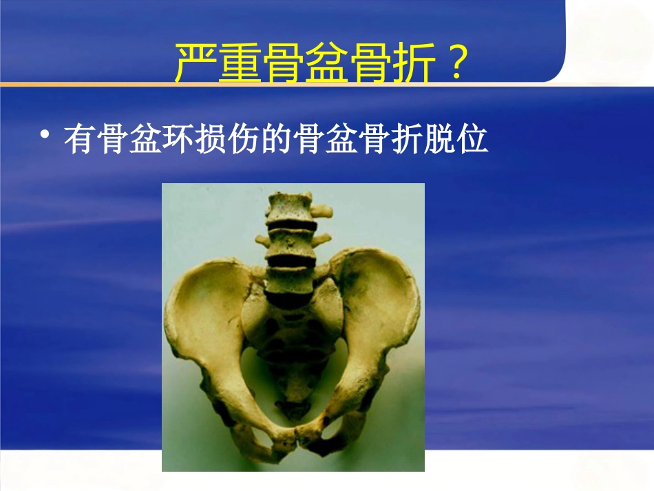 严重骨盆骨折的急救处理_第2页