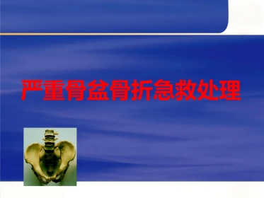 严重骨盆骨折的急救处理