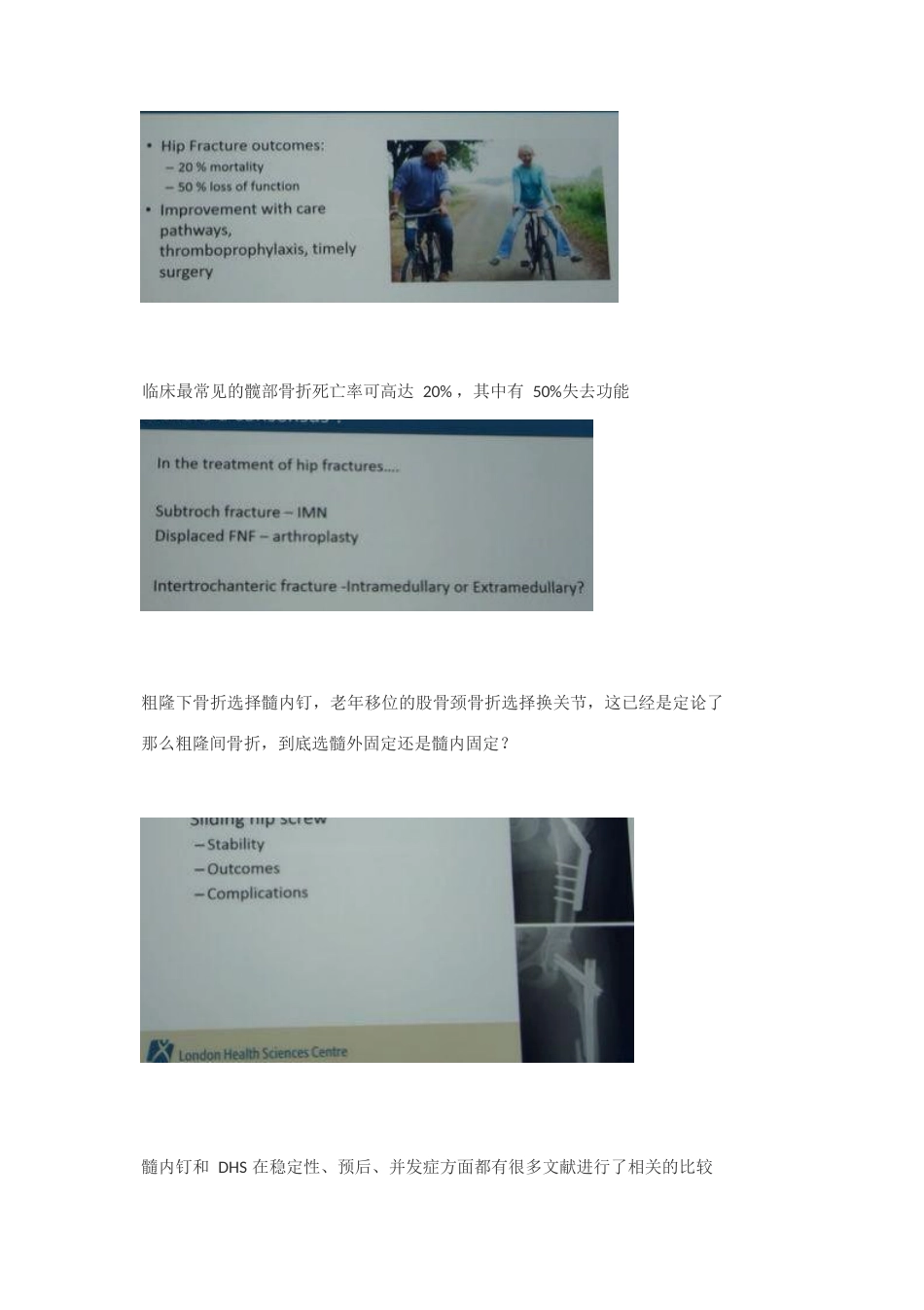 粗隆间骨折如何选择内固定_第1页