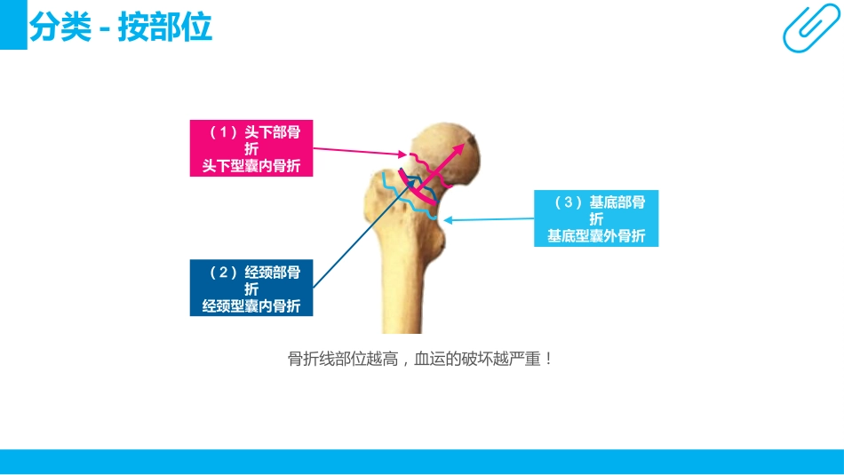 骨科-股骨颈骨折护理查房_第12页
