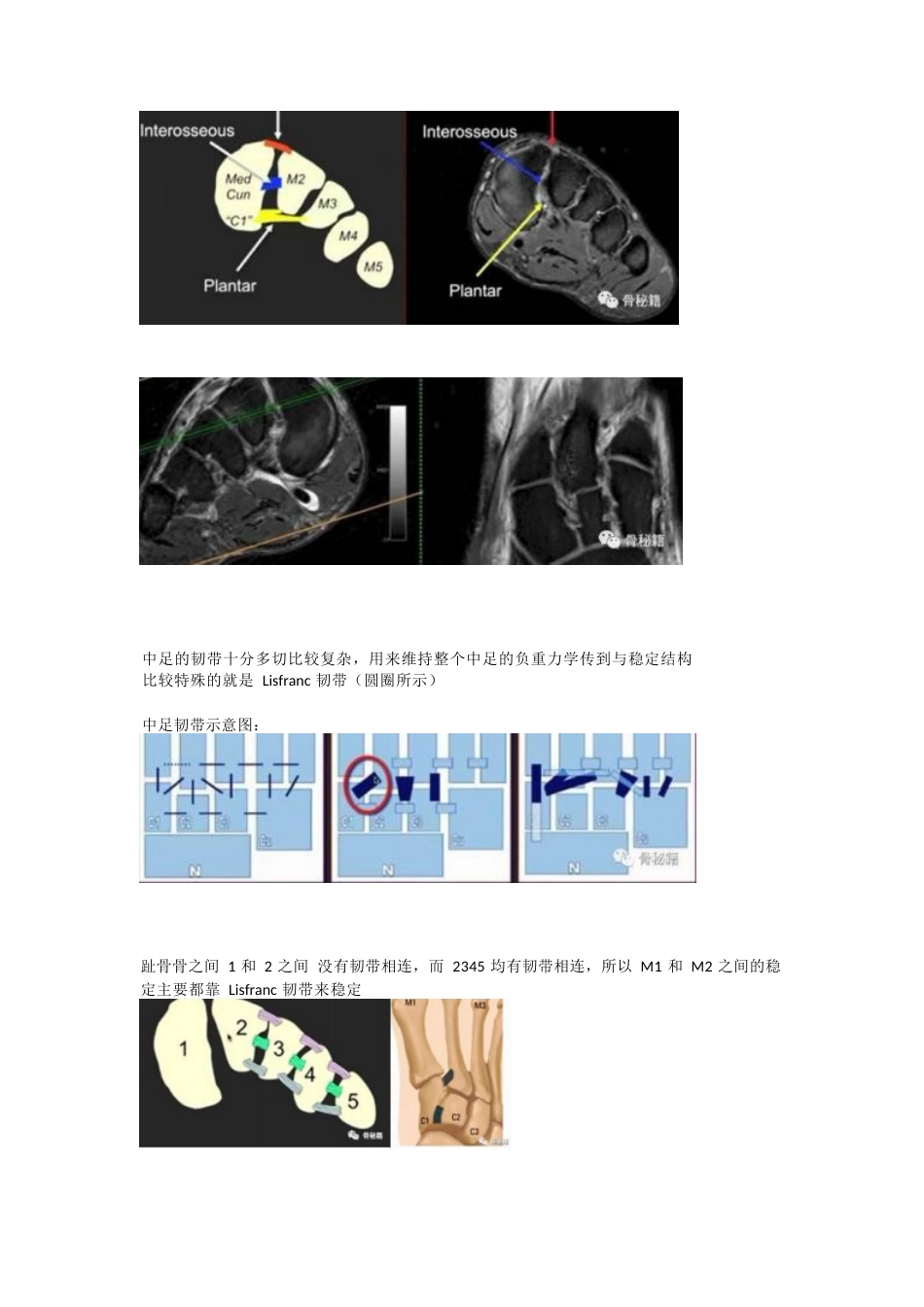 跖跗关节（Lisfranc）损伤的治疗策略与技巧_第2页