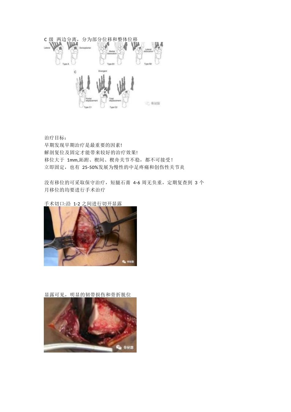 跖跗关节（Lisfranc）损伤的治疗策略与技巧_第6页
