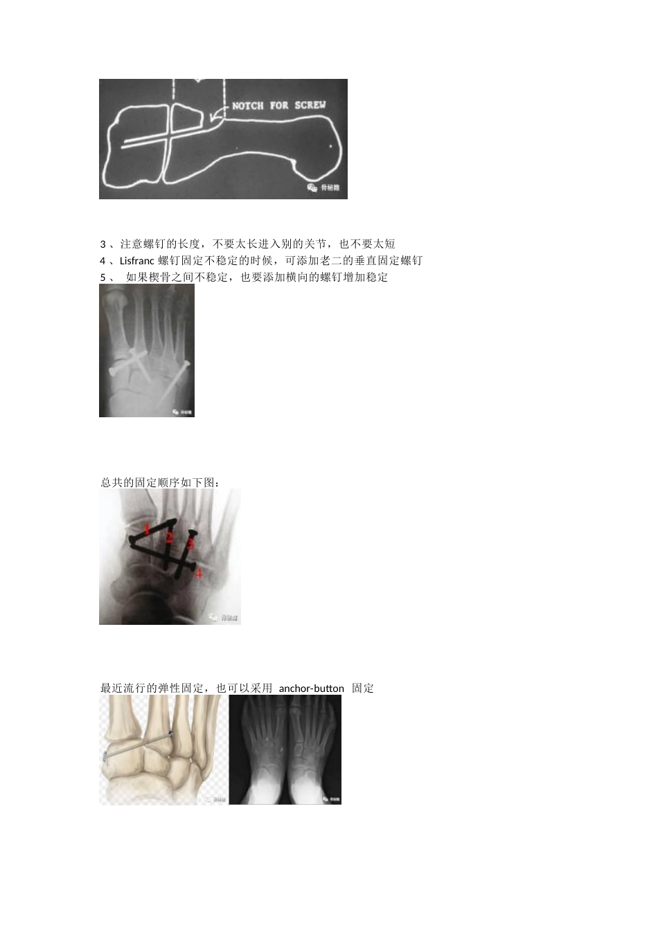 跖跗关节（Lisfranc）损伤的治疗策略与技巧_第8页