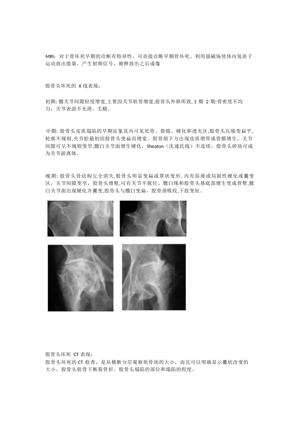 股骨头坏死的诊断与治疗策略_第5页