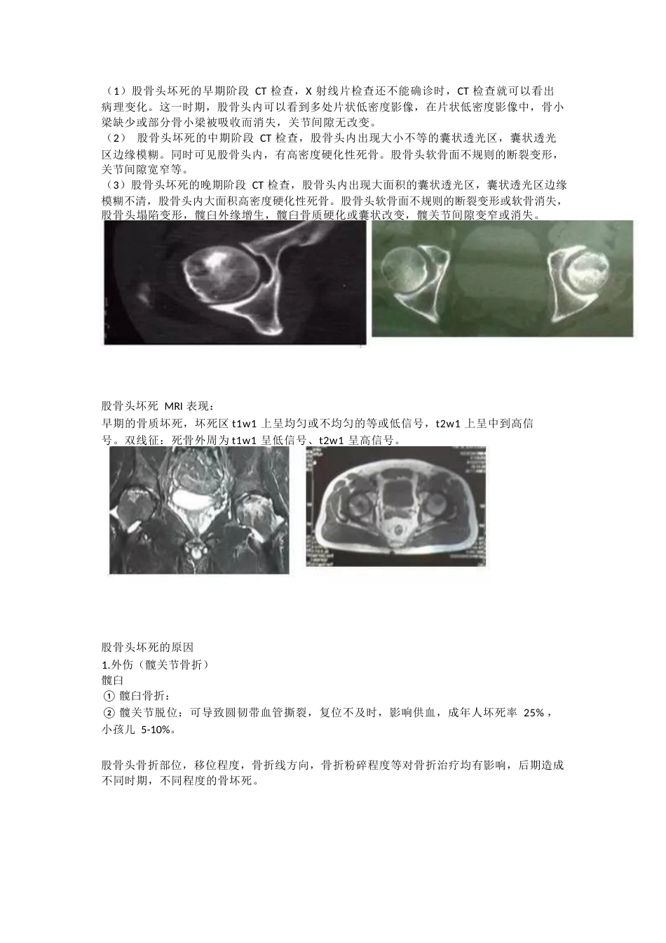 股骨头坏死的诊断与治疗策略_第6页