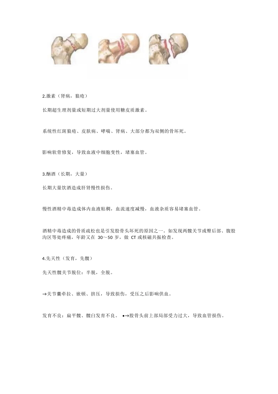 股骨头坏死的诊断与治疗策略_第7页