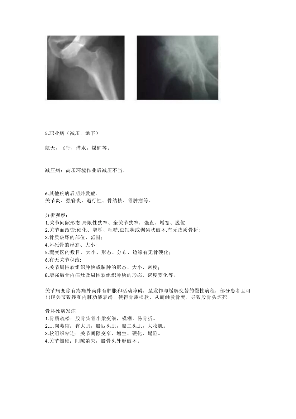 股骨头坏死的诊断与治疗策略_第8页
