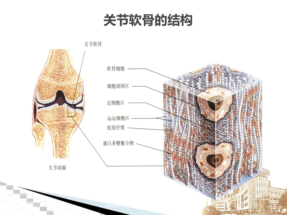 膝关节骨关节炎研究进展_第13页