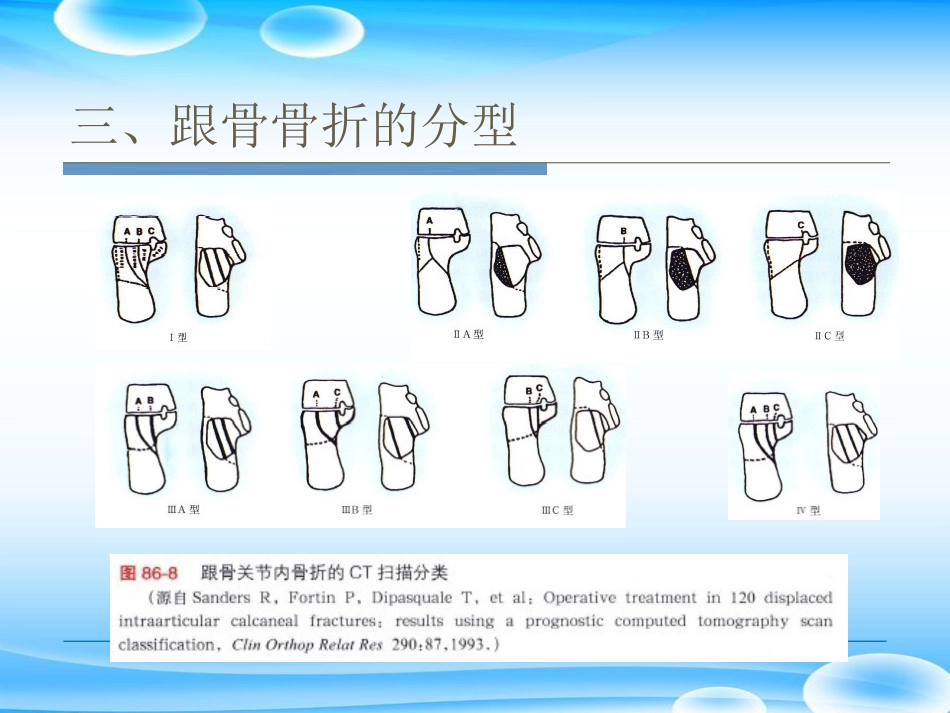 跟骨骨折ORIF的技巧PPT课件_第12页