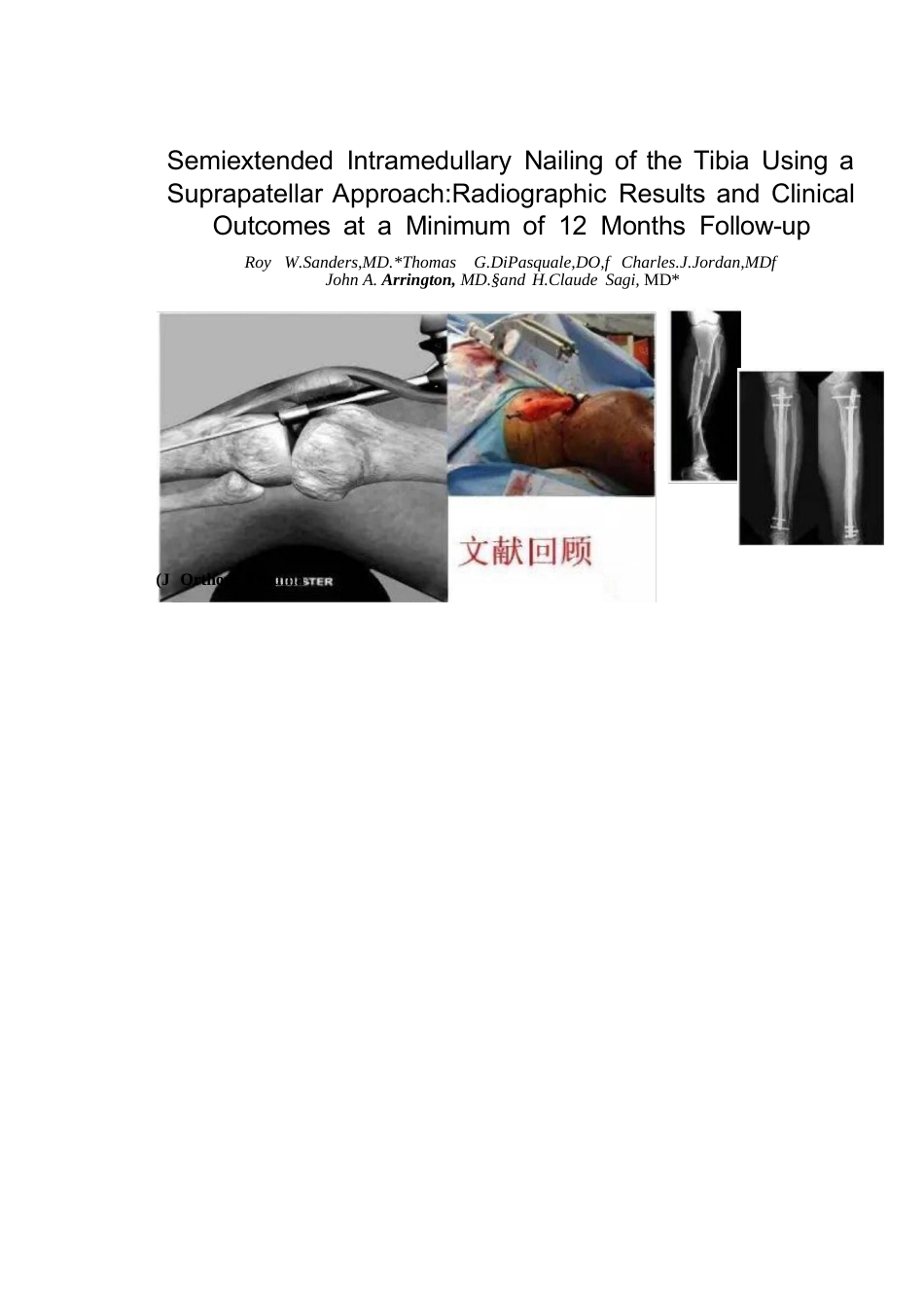 髓内钉治疗胫骨近端骨折技术_第12页