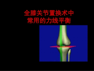 截骨力线