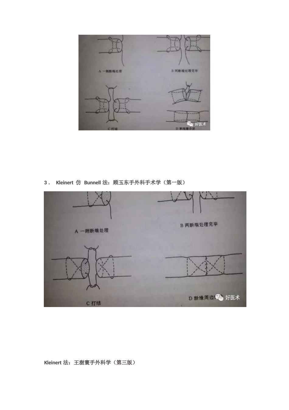 肌腱缝合术方法汇总_第6页