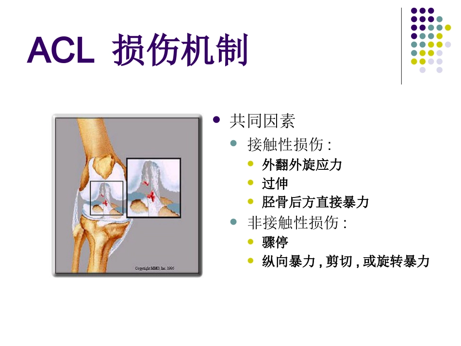 膝关节前交叉韧带损伤诊断与治疗_第3页