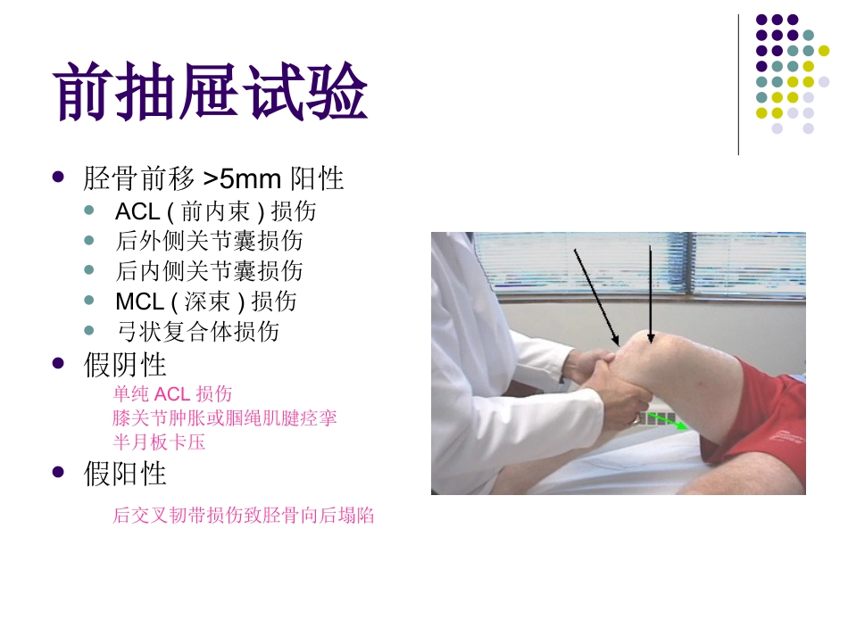 膝关节前交叉韧带损伤诊断与治疗_第7页