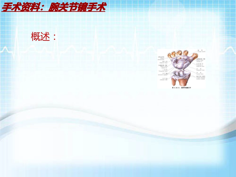 手术讲解模板：腕关节镜手术_第5页