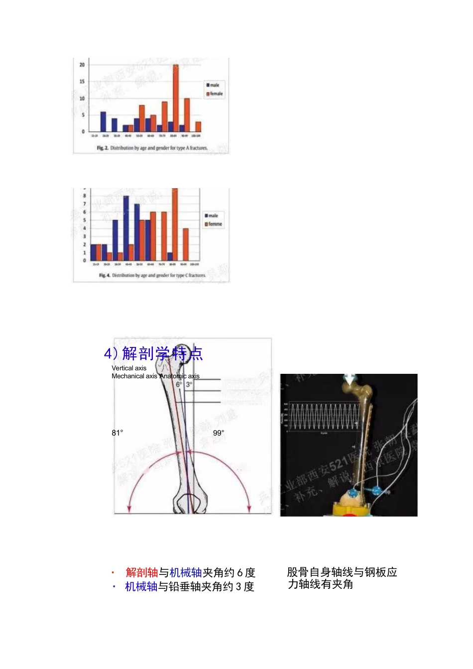 股骨远端骨折的手术治疗技巧_第7页