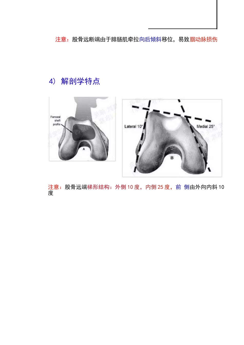 股骨远端骨折的手术治疗技巧_第9页