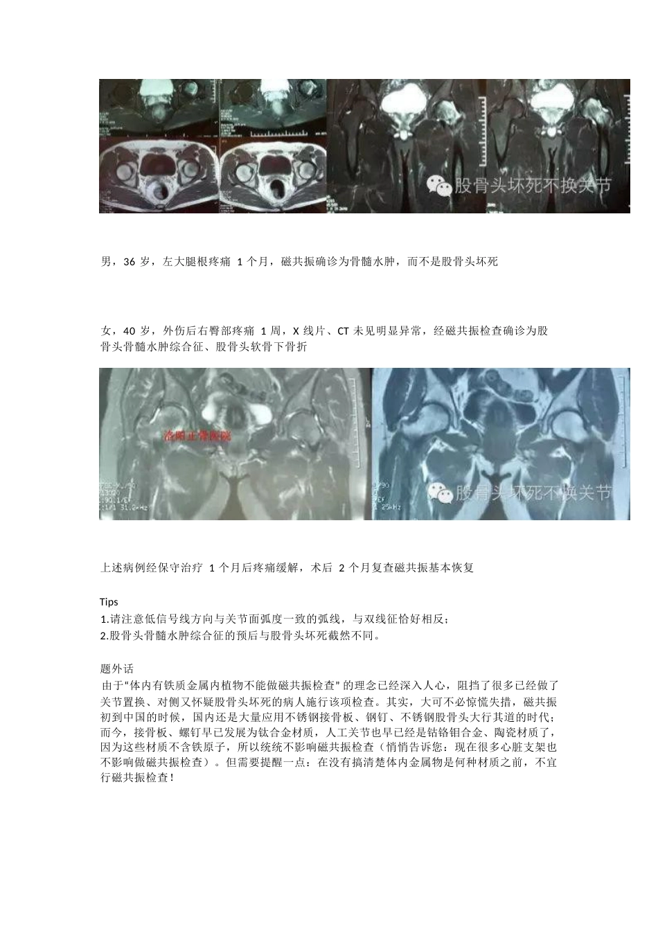 股骨头坏死应该怎样做检查_第7页