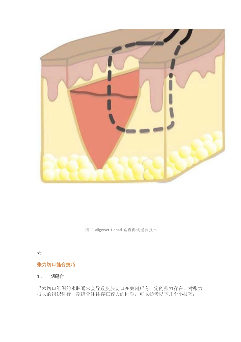 骨科手术切口管理_第6页