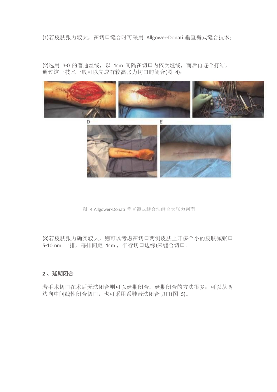 骨科手术切口管理_第7页