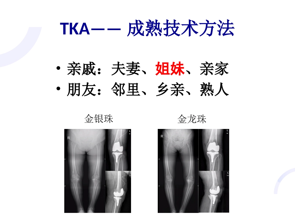UKA与TKA 如何选择？_第4页