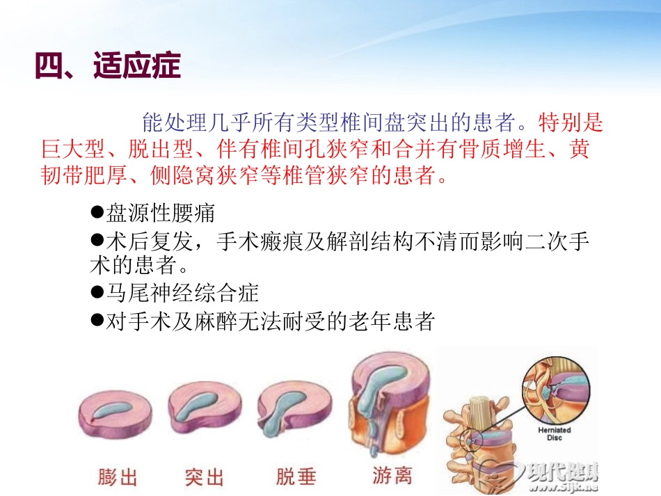 椎间孔镜技术_第14页