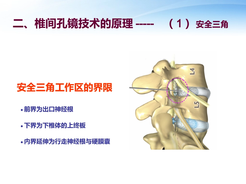 椎间孔镜技术_第3页