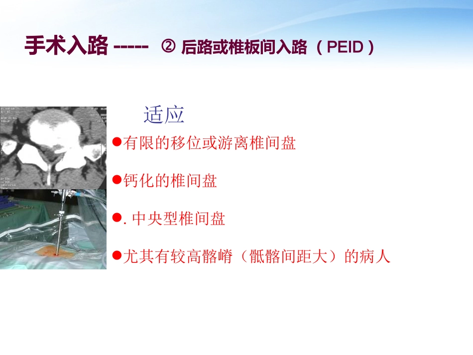 椎间孔镜技术_第8页