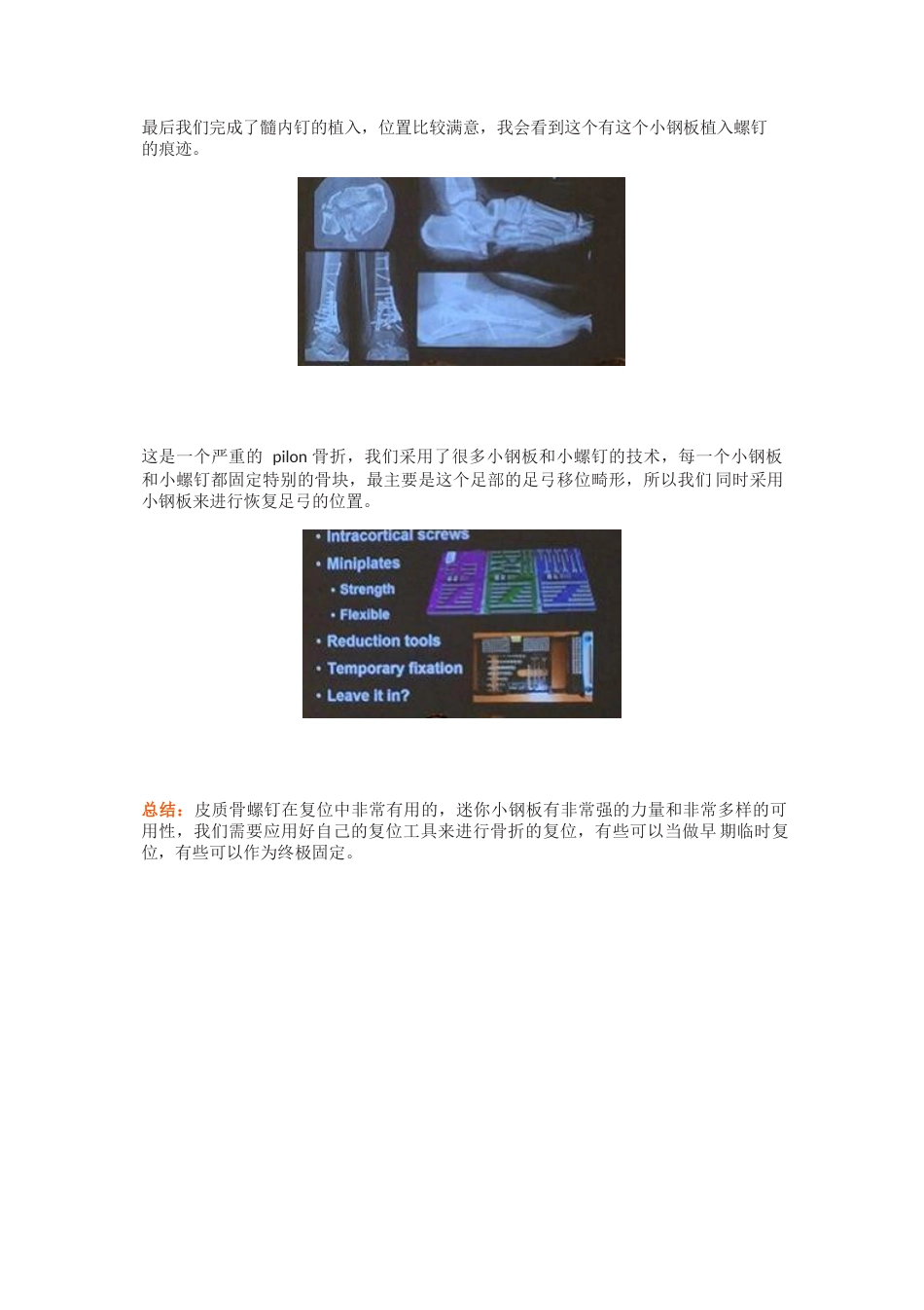 全皮质骨螺钉与迷你钢板的复位技巧_第6页